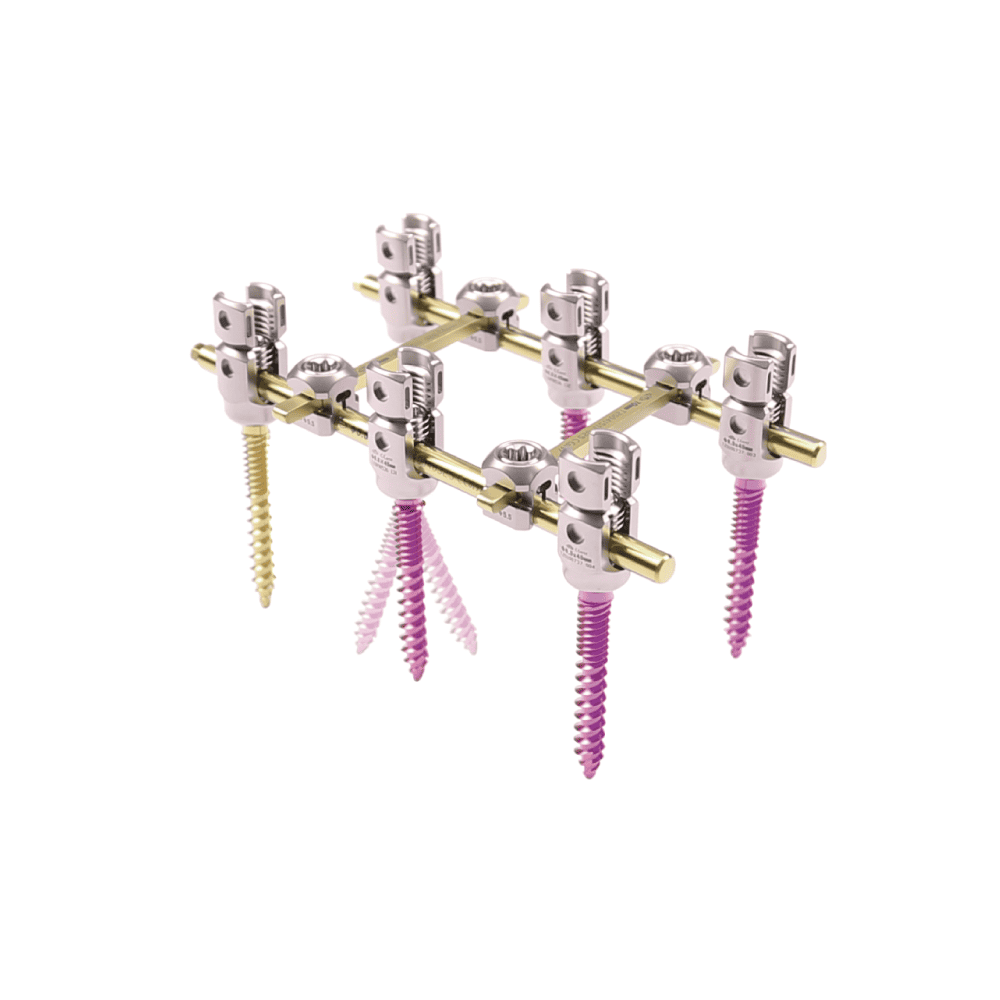 JZPA 5.5 Spinal Fixation System • Kangli Orthopedics JZPA 5.5 Spinal Fixation System