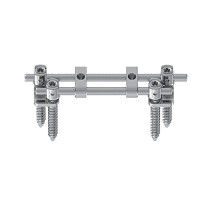 KSS-II 5.5 Anterior Thoracolumbar Double Rods System • Kangli Orthopedics KSS-II 5.5 Anterior Thoracolumbar Double Rods System