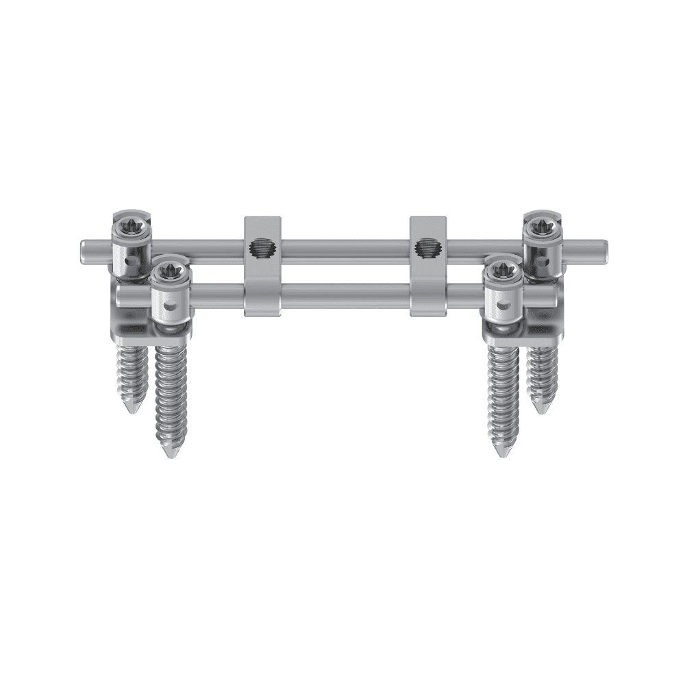 KSS-II 5.5 Anterior Thoracolumbar Double Rods System • Kangli Orthopedics KSS-II 5.5 Anterior Thoracolumbar Double Rods System