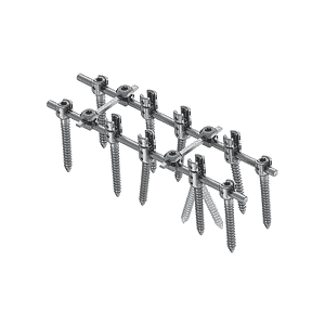 KSS-II 5.5 Spinal Fixation System (Posterior Fixation) • Kangli Orthopedics KSS-II 5.5 Spinal Fixation System (Posterior Fixation)