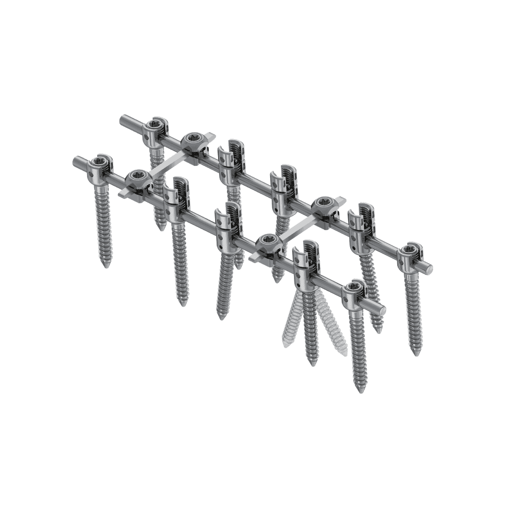 KSS-II 5.5 Spinal Fixation System (Posterior Fixation) • Kangli Orthopedics KSS-II 5.5 Spinal Fixation System (Posterior Fixation)