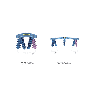 Anterior Cervical Plate-II System View • Kangli Orthopedics Anterior Cervical Plate-II System