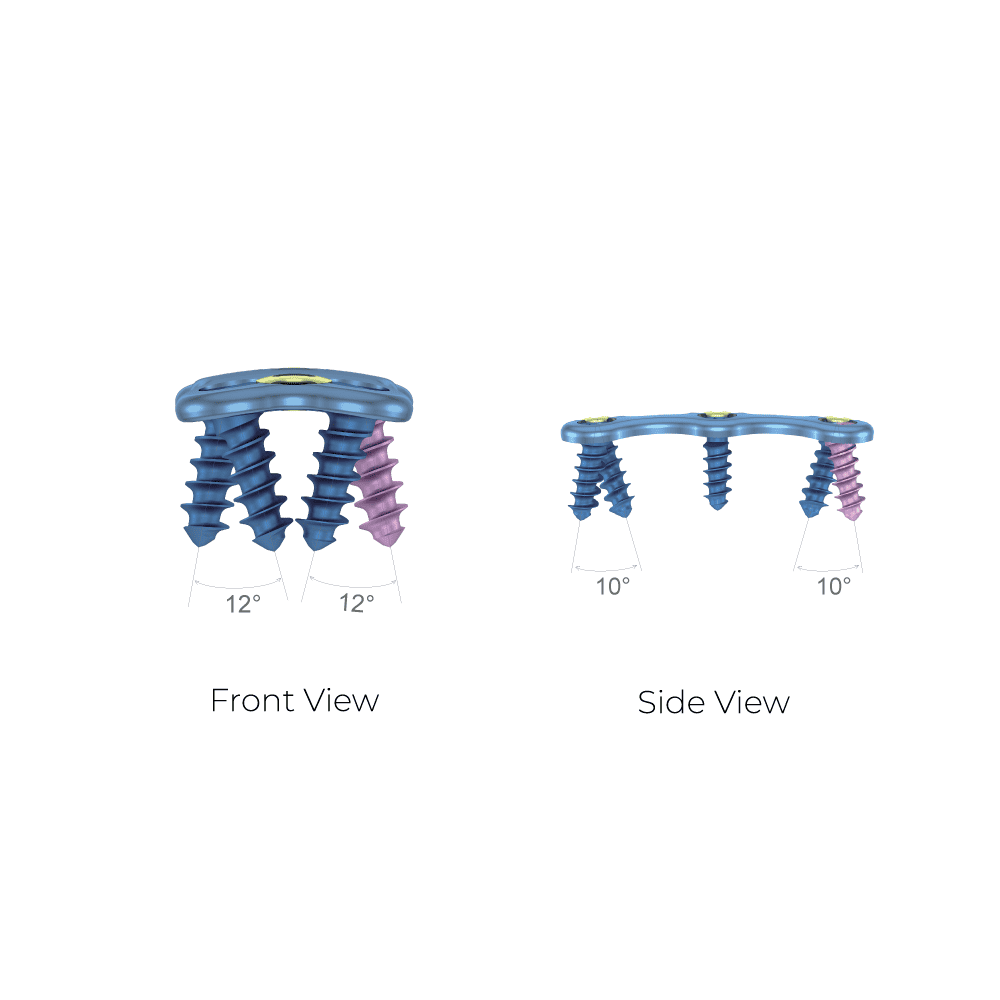 Anterior Cervical Plate-II System View • Kangli Orthopedics Anterior Cervical Plate-II System