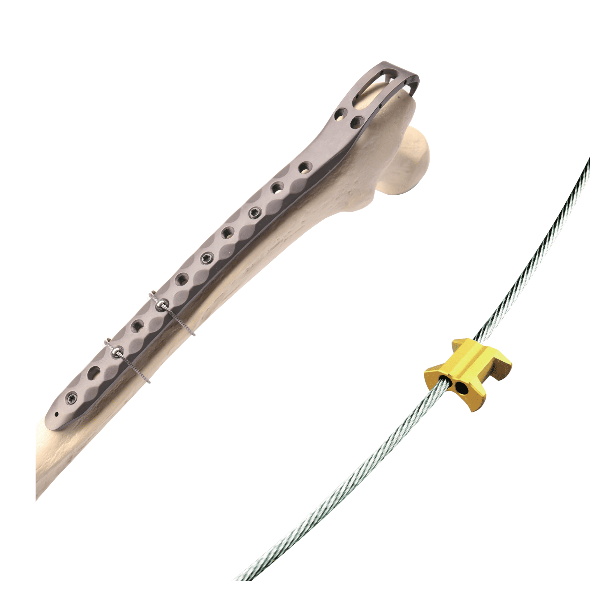 G-T771 • Kangli Orthopedics Titanium Cable System