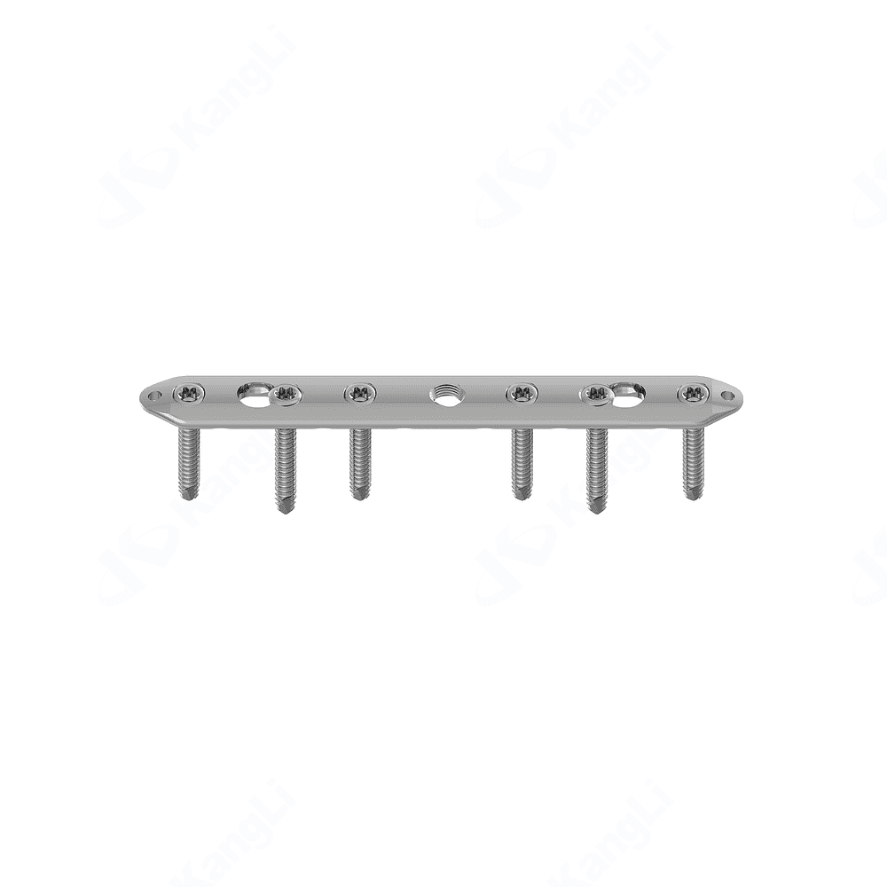 Ulna Radius Locking Plate • Kangli Orthopedics Ulna Radius Locking Plate