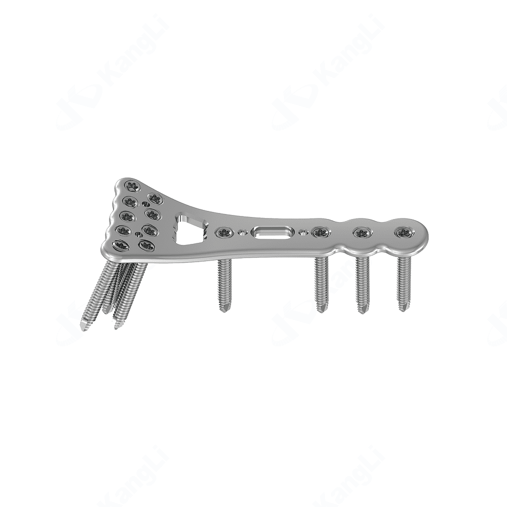 2.7 Distal Radius Buttress Locking Plate (Large) • Kangli Orthopedics 2.7 Distal Radius Buttress Locking Plate (Large)