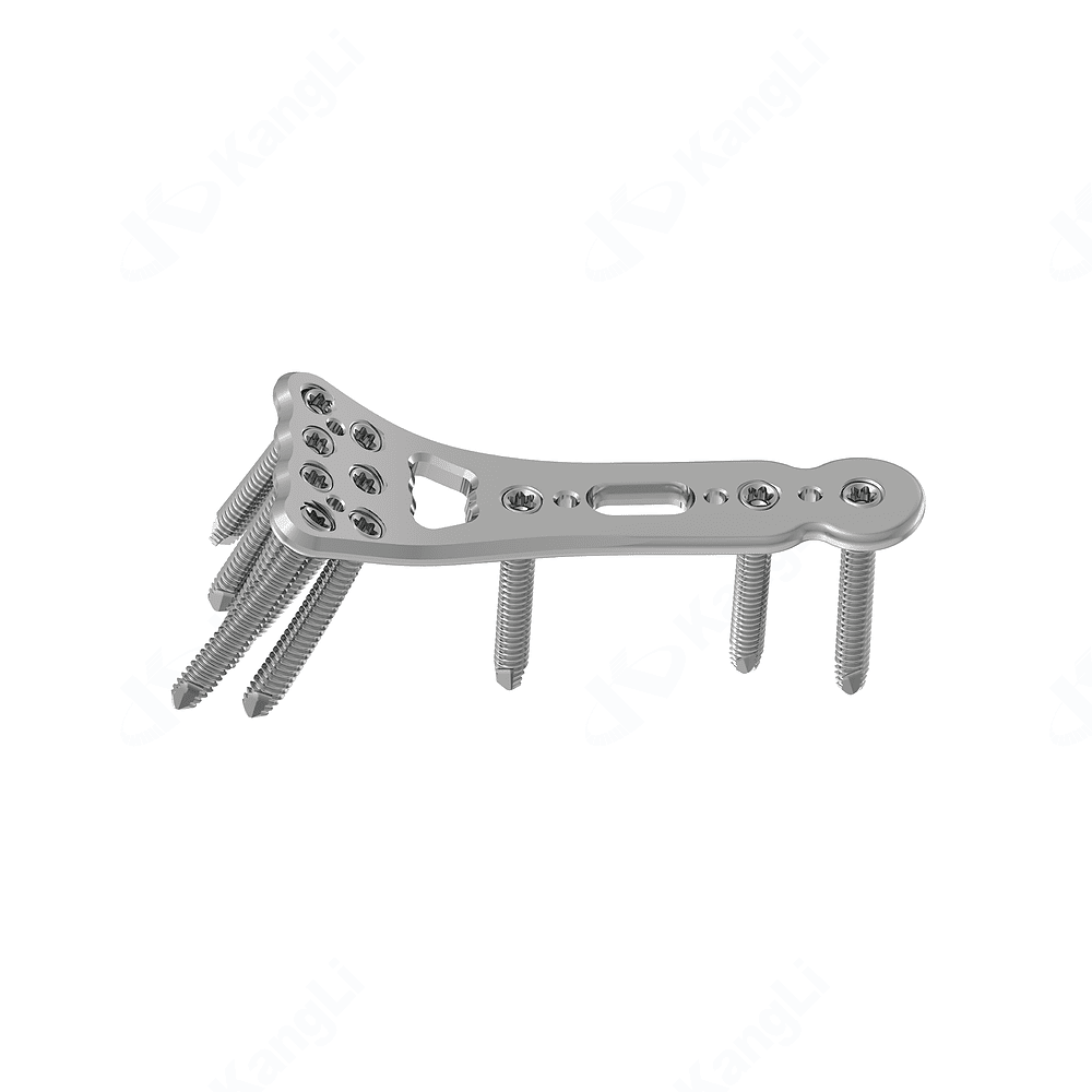 2.7 Distal Radius Buttress Locking Plate (Mini) • Kangli Orthopedics 2.7 Distal Radius Buttress Locking Plate (Mini)