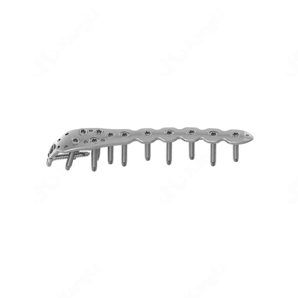 Proximal Ulna Locking Plate • Kangli Orthopedics Proximal Ulna Locking Plate