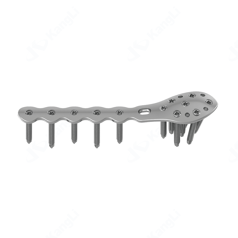 2.7 Disyal Fibula Reconstruction Locking Plate • Kangli Orthopedics 2.7 Disyal Fibula Reconstruction Locking Plate