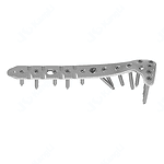 KSL Proximal Lateral Tibial Locking Plate • Kangli Orthopedics KSL Proximal Lateral Tibial Locking Plate