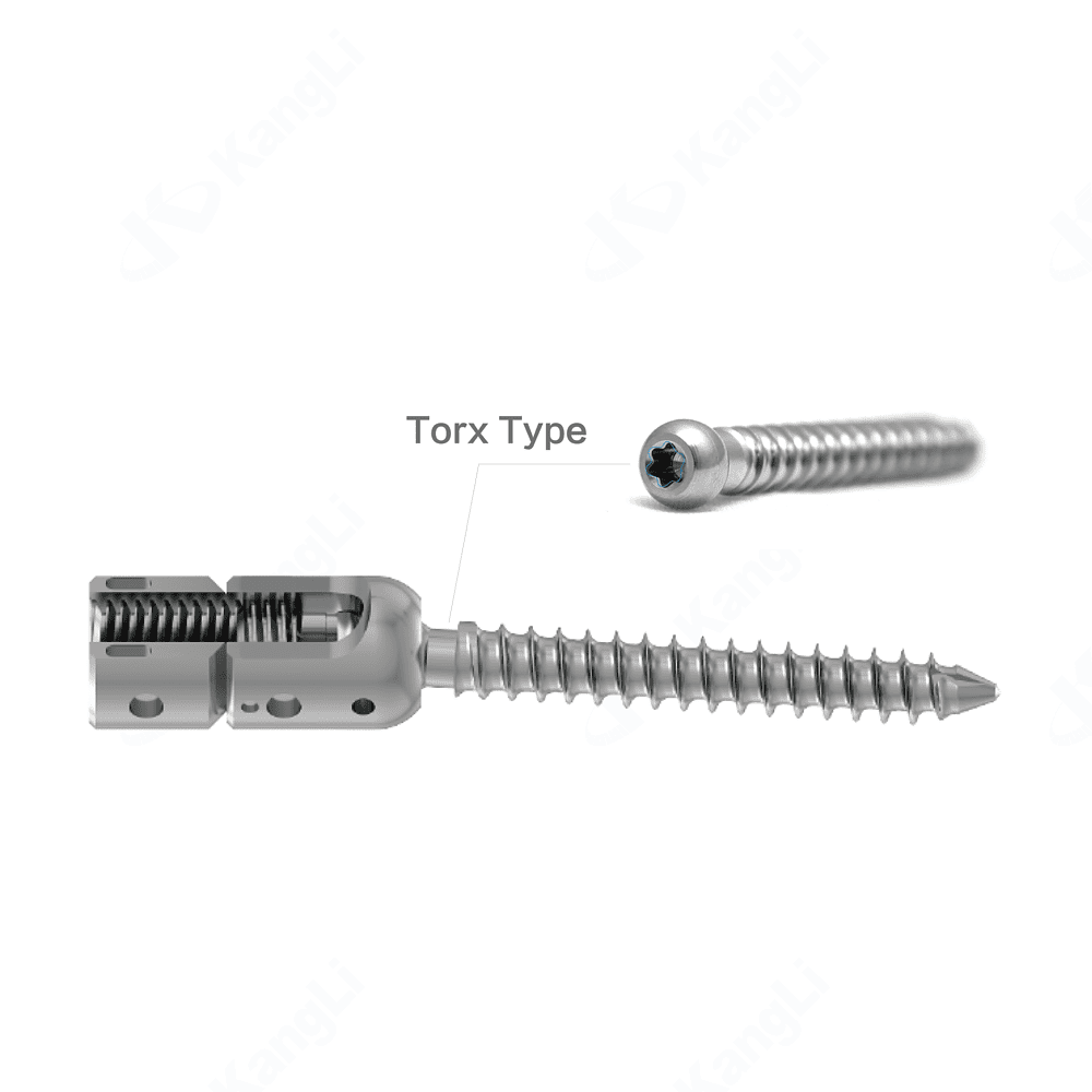 KSS 6.0 Multiaxial Reduction Pedicle Screw (Torx Type) • Kangli Orthopedics KSS 6.0 Multiaxial Reduction Pedicle Screw (Torx Type)
