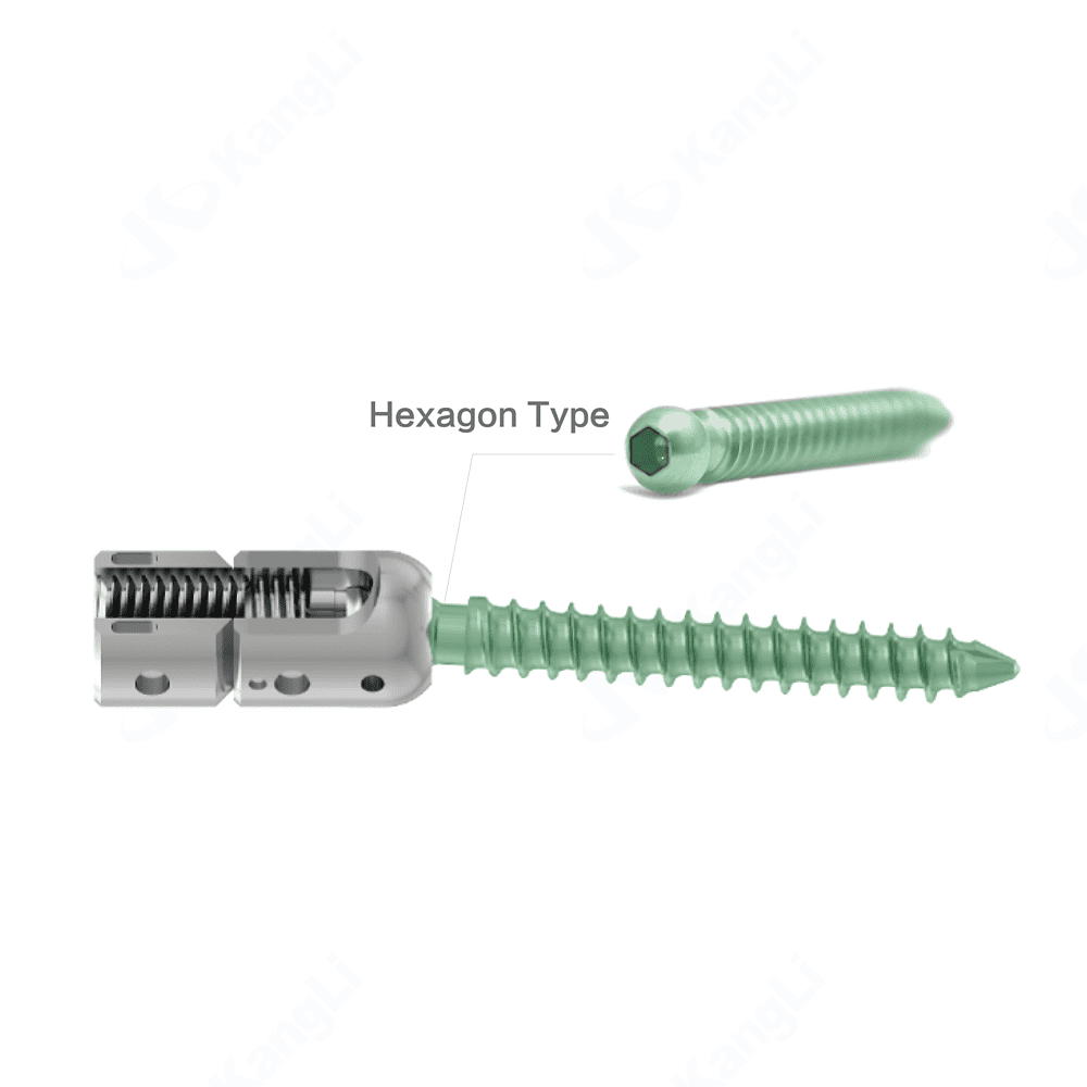 KSS 6.0 Multiaxial Reduction Pedicle Screw (Hexagon Type) • Kangli Orthopedics KSS 6.0 Multiaxial Reduction Pedicle Screw (Hexagon Type)